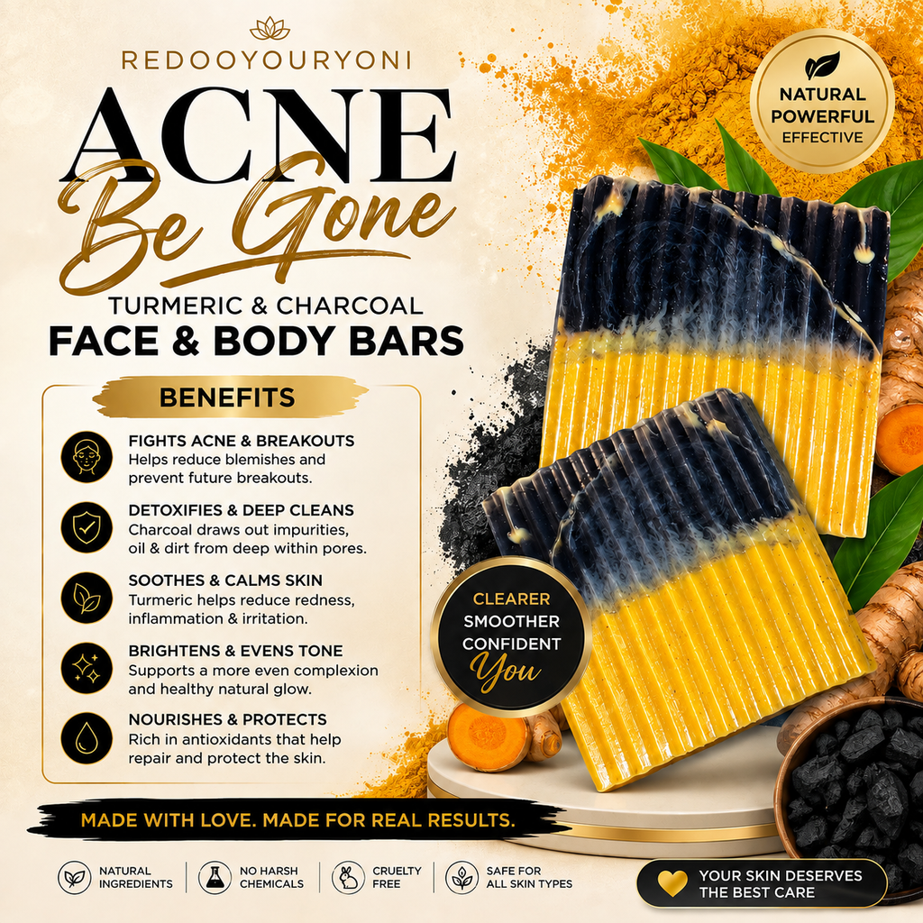 Acne be gone bars