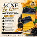 Acne be gone bars